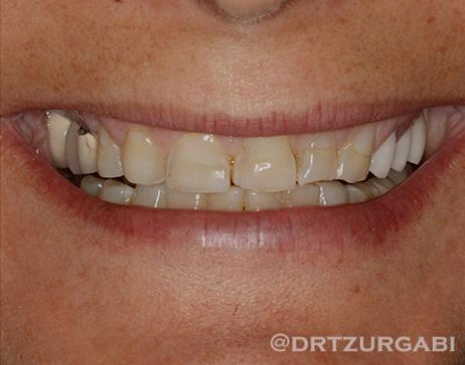 Before Image