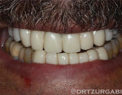 Before Image
